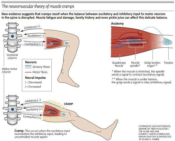 Exercise Induced Muscle Cramps – Paradise Tri Training